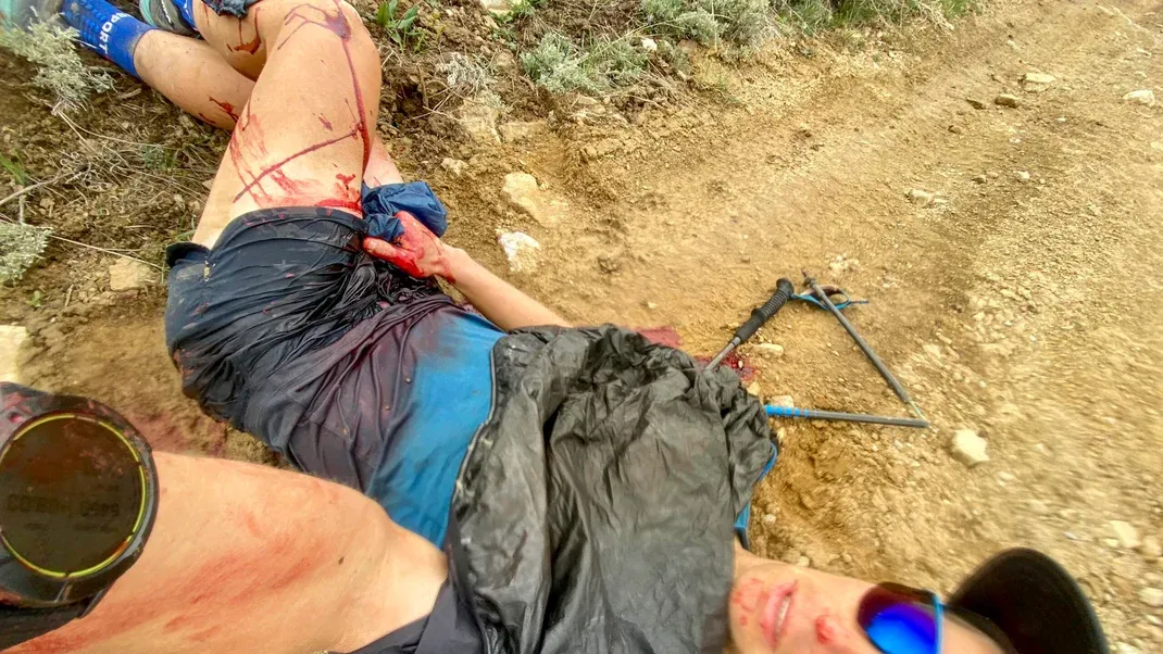 Stabbed by a Trekking Pole in the Wind River Mountains